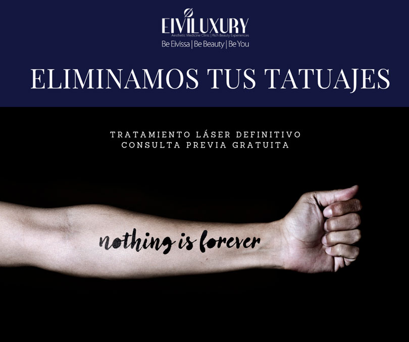 Foto eliminación tatuajes